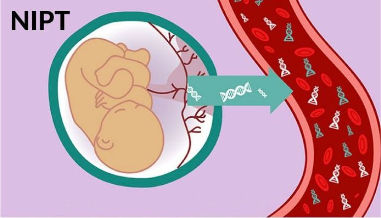 NIPT tích hợp THALASSEMIA:  thêm một lựa chọn trong  chương trình sàng lọc trước sinh